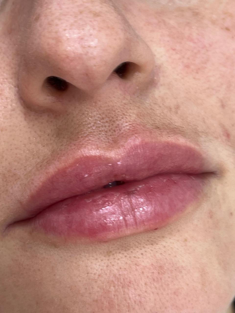 Estética dos lábios - detalhe 2