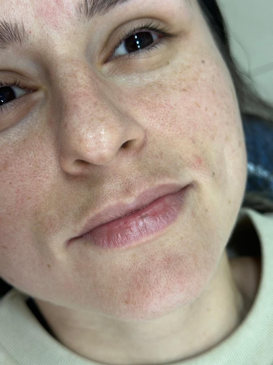 Estética dos lábios - detalhe 1